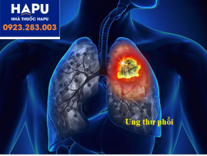 ung thư phổi là gì