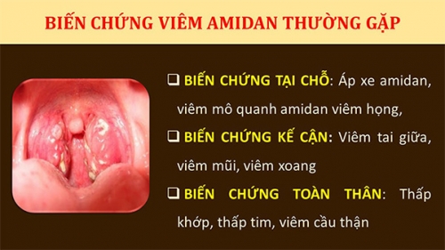 Biến-chứng-của-viêm-amidan