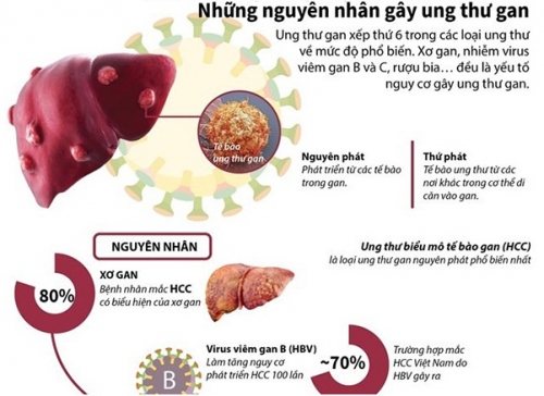 Nguyên-nhân-gây-ra-ung-thư-biểu-mô-tế-bào-gan