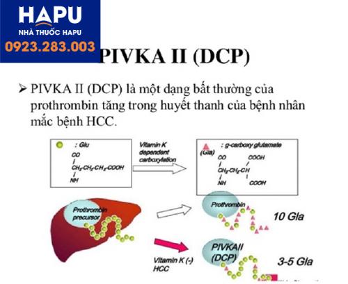 Xét-nghiệm-DCP