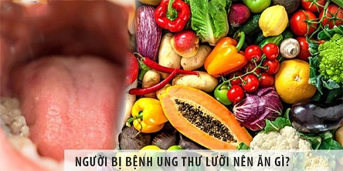 ung-thư-lưỡi-nên-ăn-gì