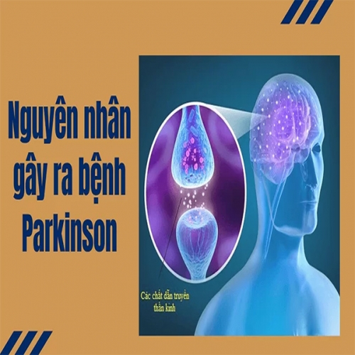 Nguyên-nhân-gây-ra-bệnh-Parkinson