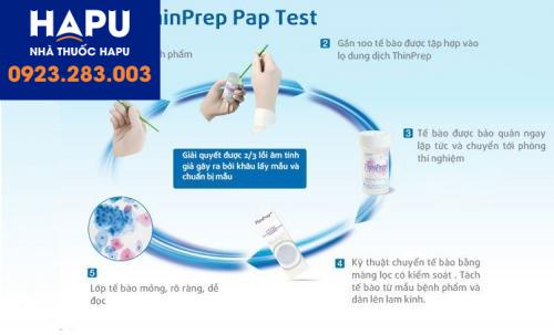 Tóm tắt quy trình xét nghiệm Thinprep