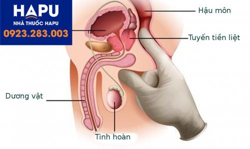 ung thư tuyến tiền liệt giai đoạn cuối