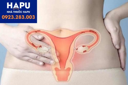 HPV và ung thư cổ tử cung