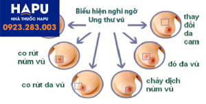 Các bệnh lý tuyến vú thường gặp và chẩn đoán khối u tuyến vú