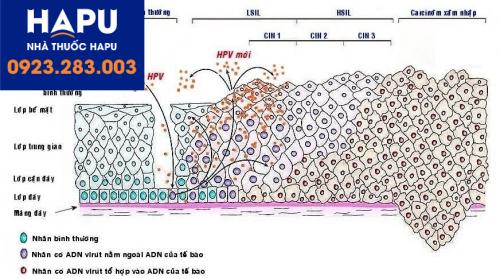 Cơ chế gây ung thư của virus hpv