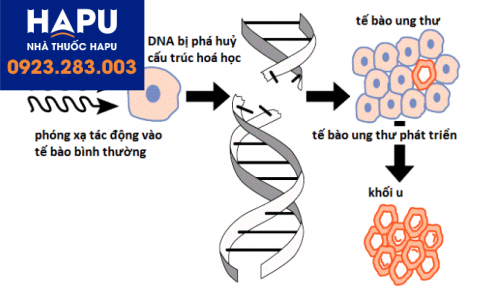 Nguyên nhân nào gây ung thư vú ở nam giới?