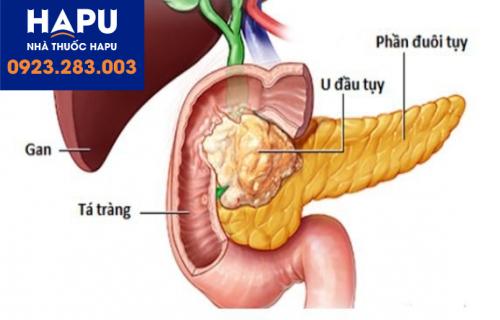 liệu pháp miễn dịch