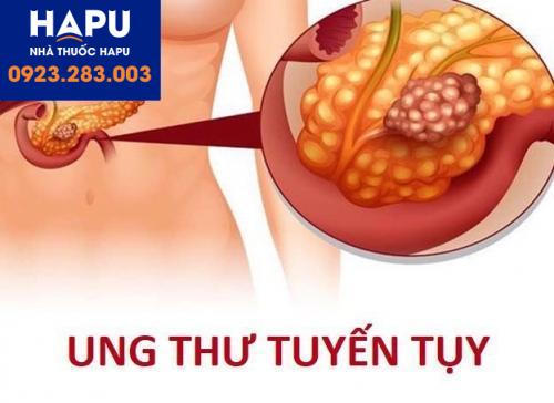 ung thư tuyến tụy