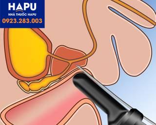 kết quả sinh thiết tiền liệt tuyến