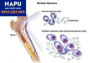 Các loại ung thư biểu mô: tế bào đáy, tế bào vảy, tế bào chuyển tiếp