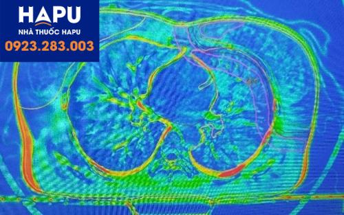 so sánh giữa mô phỏng và CBCT