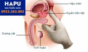 Tầm soát phát hiện sớm bệnh ung thư tuyến tiền liệt như thế nào?