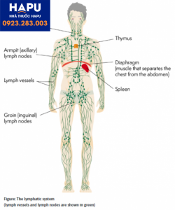 Cẩn trọng với bệnh lý u lympho và một số dấu hiệu của bệnh