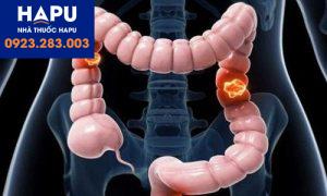 Polyp đại tràng là gì? Polyp đại tràng có mọc lại sau cắt không?